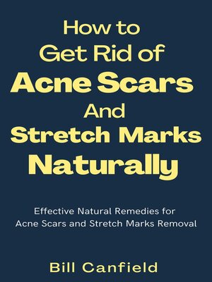 cover image of How to Get Rid of Acne Scars and Stretch Marks Naturally